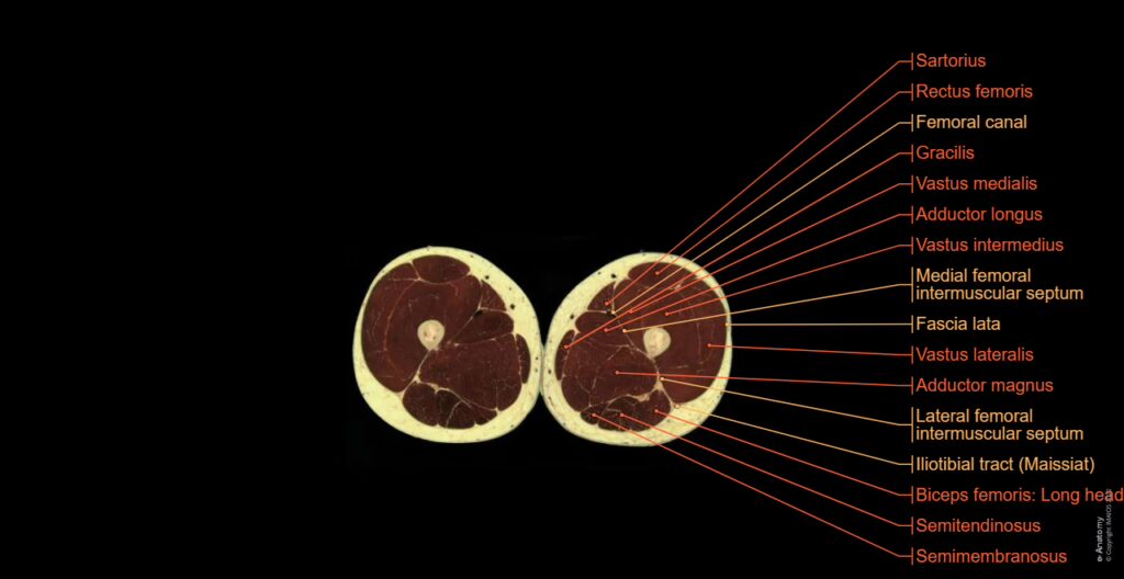 🧠 Visible Human Project (National Library of Medicine, USA)